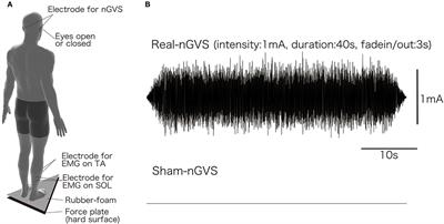 The Effects of Stochastic Galvanic Vestibular Stimulation on Body Sway and Muscle Activity
